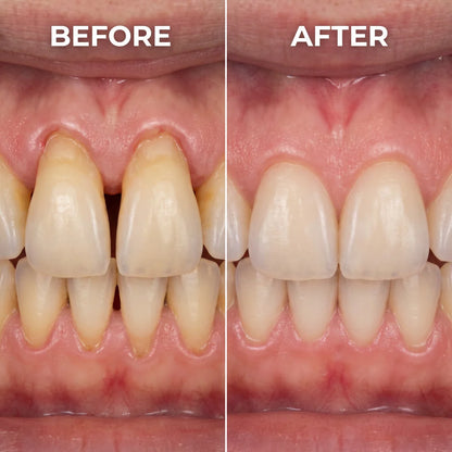 ✨ Smile Rescue Precision Gum Care Gel – A Healthier-Looking Smile Made Simple 🦷😁