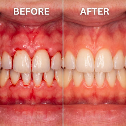 ✨ Smile Rescue Precision Gum Care Gel – A Healthier-Looking Smile Made Simple 🦷😁