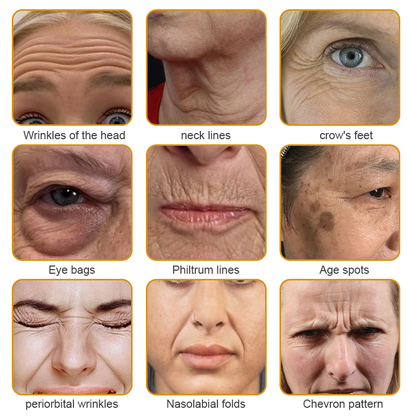 👨‍⚕️💐Made and Shipped from the USA✅ BBOJI™ Botulinum Bienengift Wrinkle Removal Cream-Last Day Promotion 70% OFF