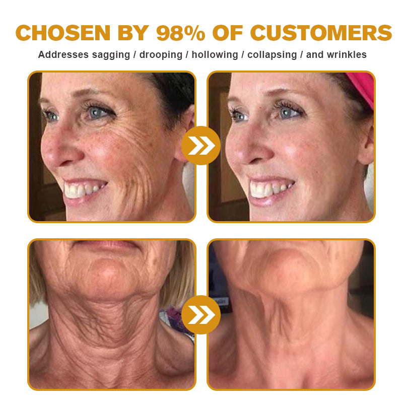 👨‍⚕️💐Made and Shipped from the USA✅ BBOJI™ Botulinum Bienengift Wrinkle Removal Cream-Last Day Promotion 70% OFF