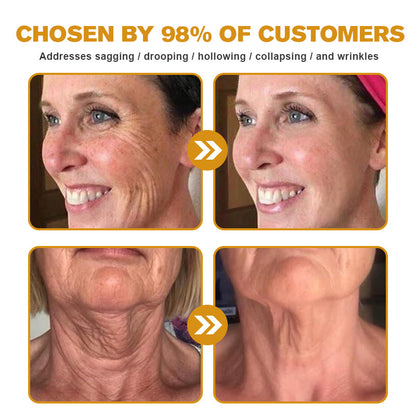 👨‍⚕️💐Made and Shipped from the USA✅ BBOJI™ Botulinum Bienengift Wrinkle Removal Cream-Last Day Promotion 70% OFF