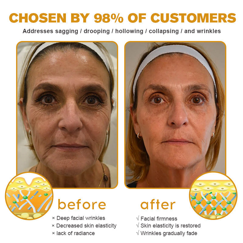 👨‍⚕️💐Made and Shipped from the USA✅ BBOJI™ Botulinum Bienengift Wrinkle Removal Cream-Last Day Promotion 70% OFF