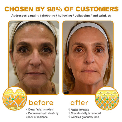 👨‍⚕️💐Made and Shipped from the USA✅ BBOJI™ Botulinum Bienengift Wrinkle Removal Cream-Last Day Promotion 70% OFF